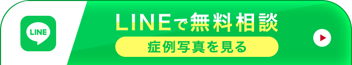 LINEで簡単予約