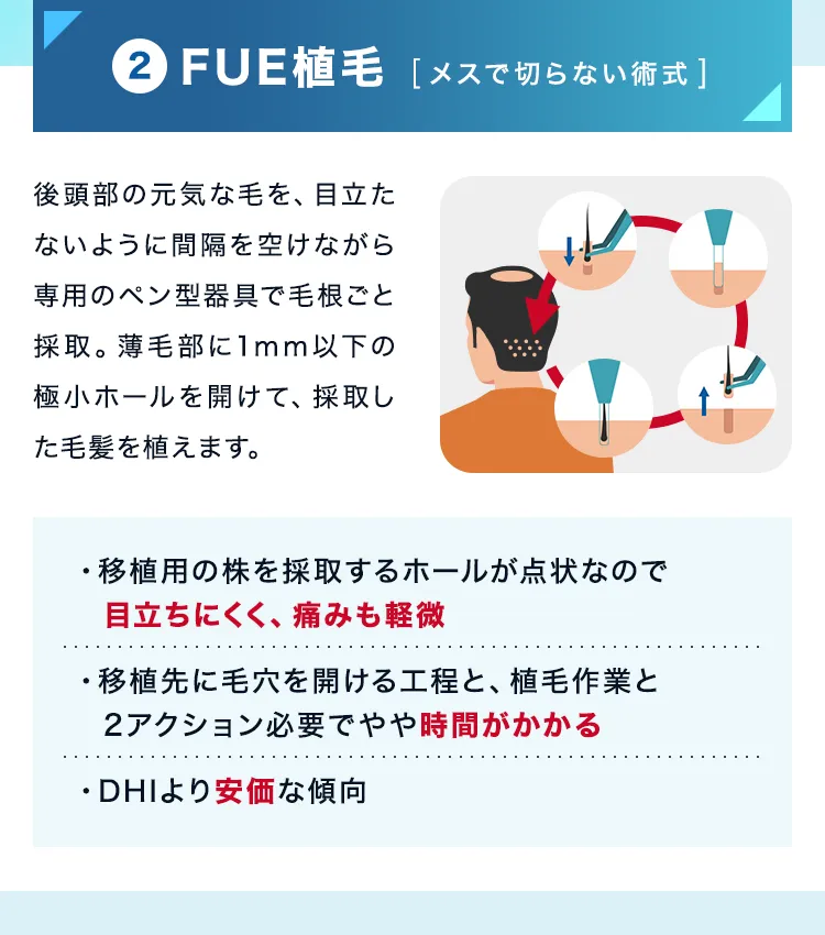 FUE植毛（メスで切らない方式）植毛の窓口で行われている植毛方法