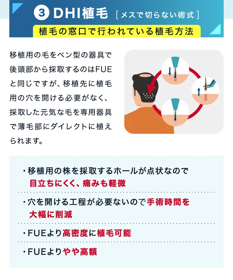 DHI植毛（メスで切らない術式）植毛の窓口で行われている植毛方法